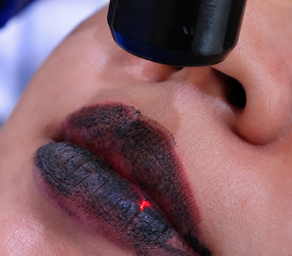 Laser Bibir Lip Pink